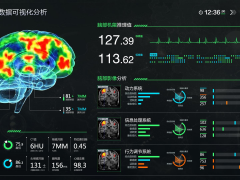 医疗大数据应用：AI预测糖尿病风险准确率达89%