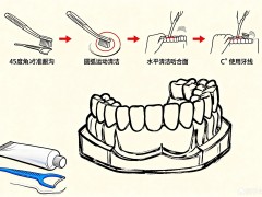 牙菌斑清除：超越刷牙的全面口腔护理