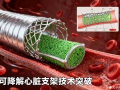 可降解心脏支架技术突破：从血管修复到自然愈合